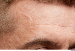 Face Hair Skin Man White Scar Wrinkles Studio photo references